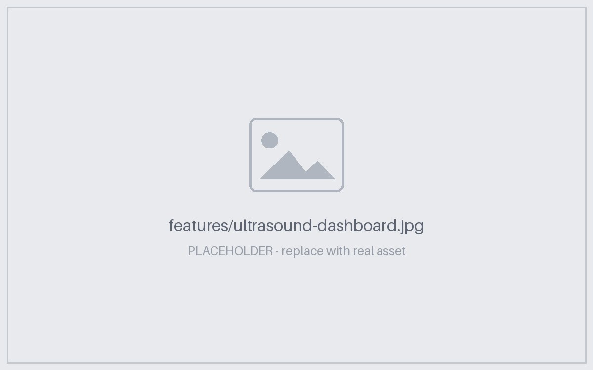 Ultrasound Interface